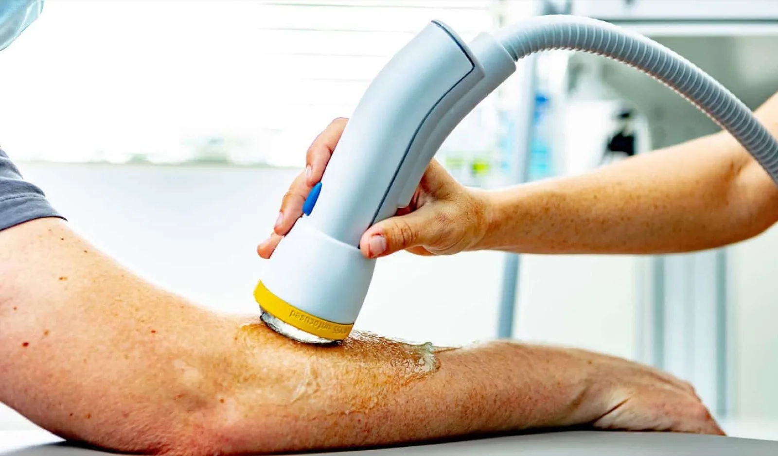 How Long Do the Benefits of Softwave Therapy Last?