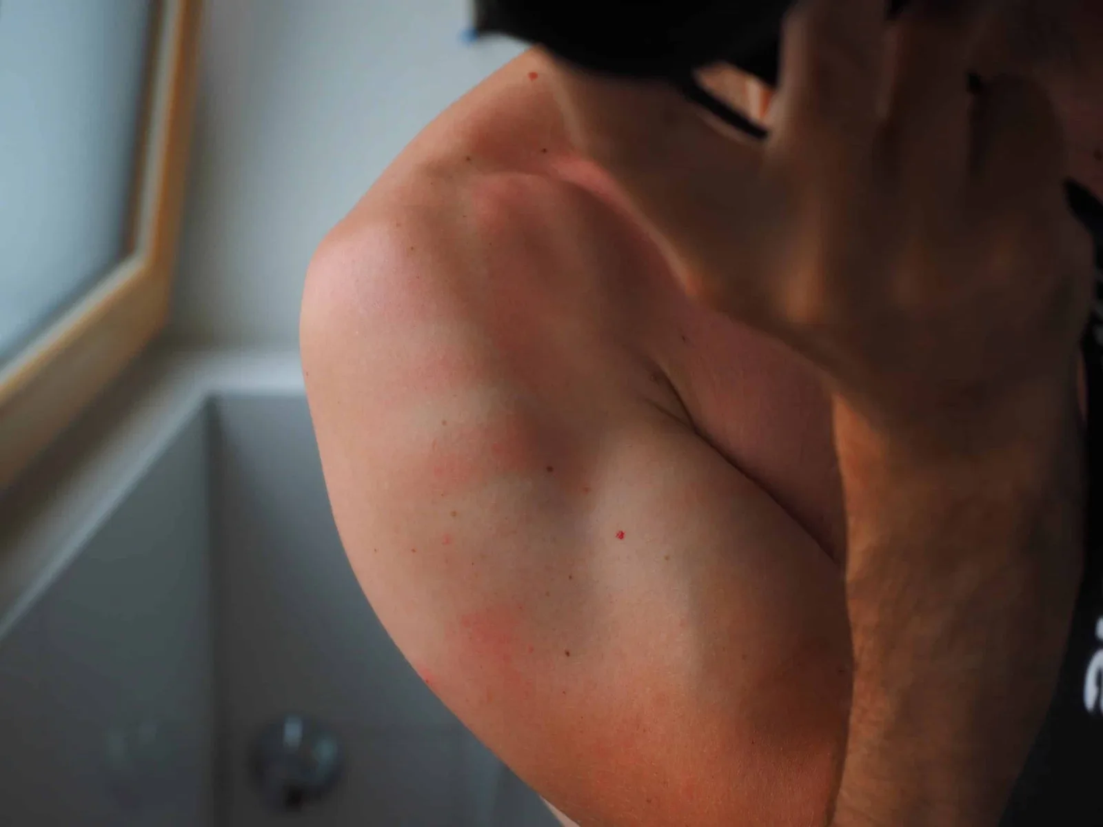 What Can a Chiropractor Do For a Pinched Nerve?