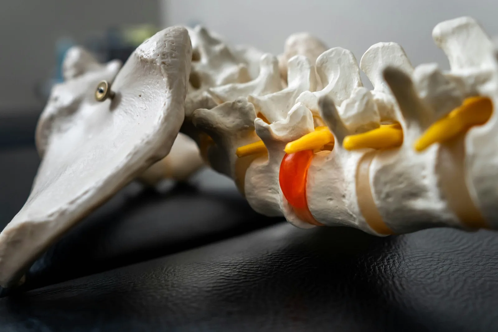 Sciatica care at Cool Springs Chiropractic, relief from shooting leg and lower back nerve pain